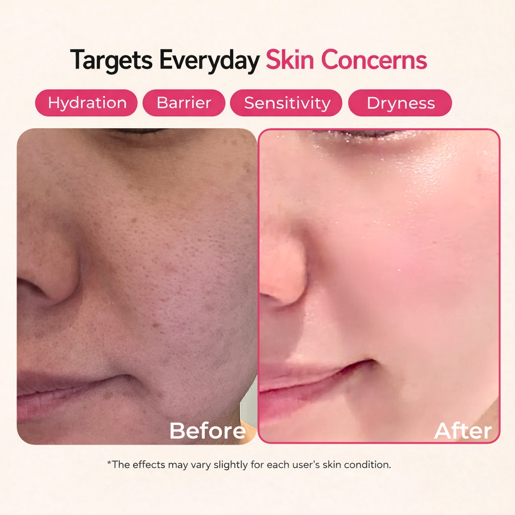 Ceramide + Ectoin Lotion