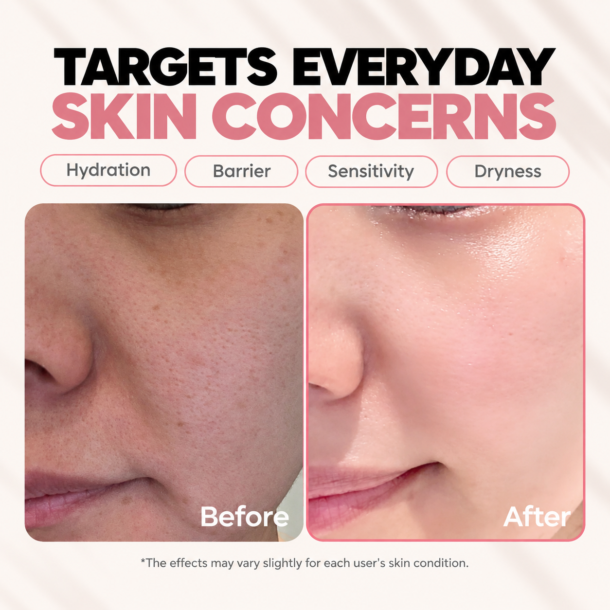 Ceramide + Ectoin Lotion