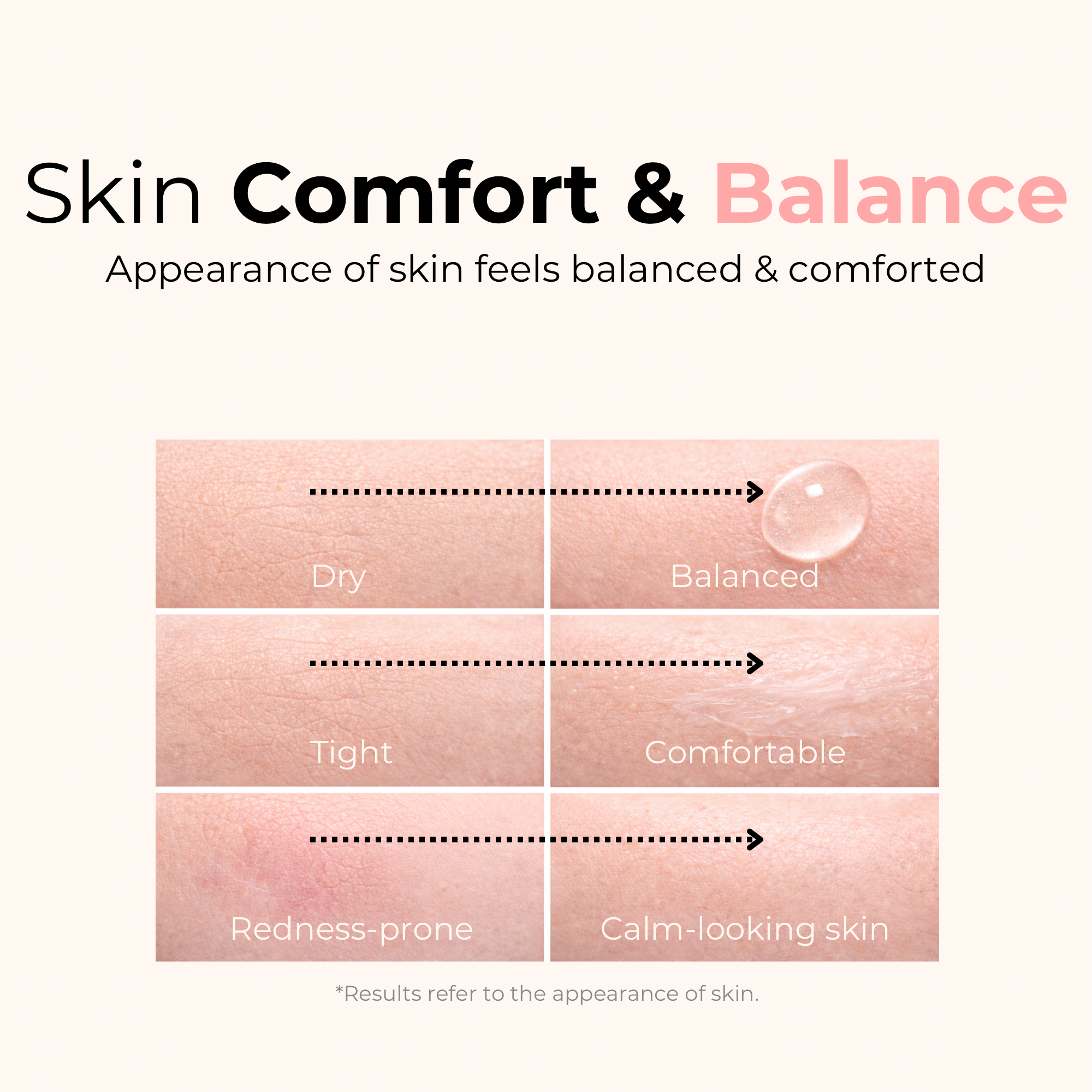 ceramide ectoin moisturizing lotion